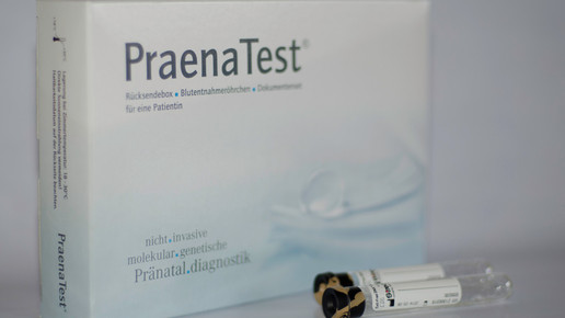 Trisomie 21-Test erweitert