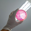 Foto: Eine Person hält eine Agarplatte mit Enterohemorrhagic Escherichia coli hoch.