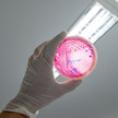 Foto: Eine Person hält eine Agarplatte mit Enterohemorrhagic Escherichia coli hoch.