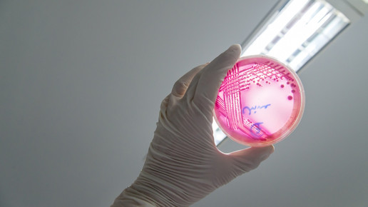 Foto: Eine Person hält eine Agarplatte mit Enterohemorrhagic Escherichia coli hoch.