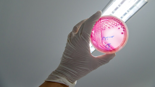 Foto: Eine Person hält eine Agarplatte mit Enterohemorrhagic Escherichia coli hoch.