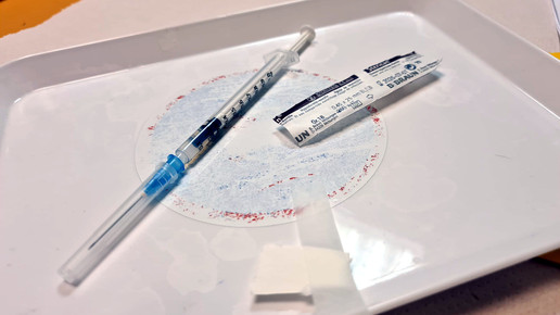 Stiko: Affenpocken-Impfung für Risikogruppen