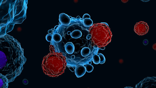 80 Prozent mehr Krebsdiagnosen