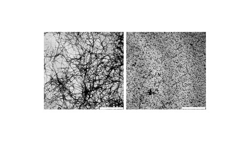 hsp-amyloid andy mainz tumuenchen