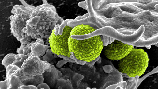 staphylococcus aureus gruen weisse blutzellen NIAID