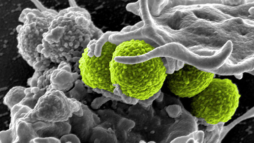 staphylococcus aureus gruen weisse blutzellen NIAID