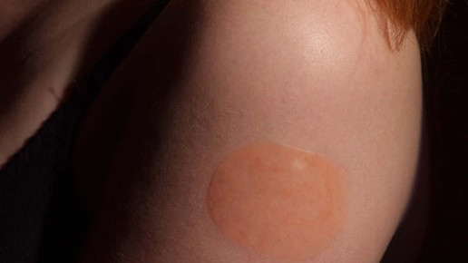 Rivalif: Transdermales Pflaster bei Demenz