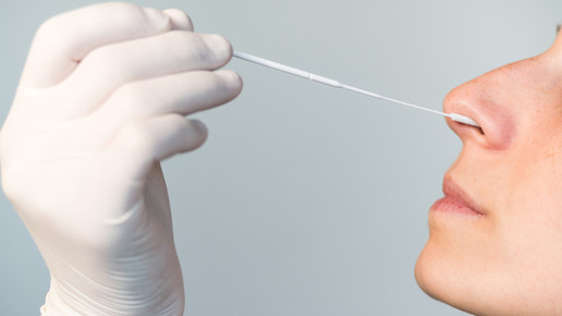 Apotheken dürfen PCR-Tests abrechnen