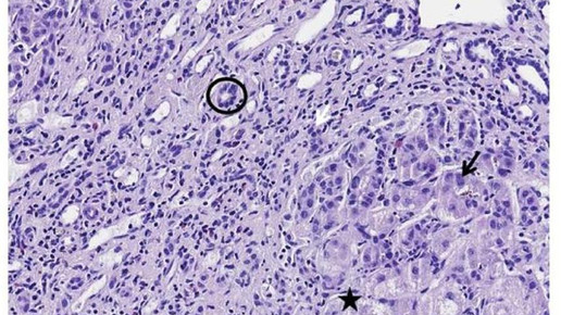 160621 kupferspeicherkrankheit helmholtz zentrum2