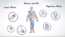 Wie IL-6 Entzündungsreaktionen reguliert
