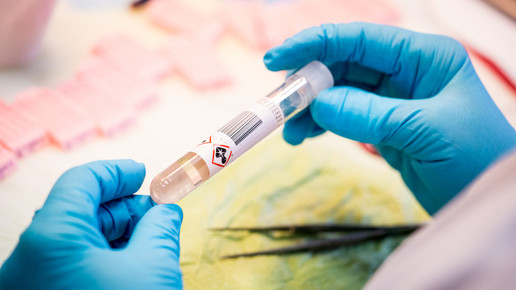 Krebs-OPs nach Fehldiagnose: Justiz ermittelt gegen Arzt