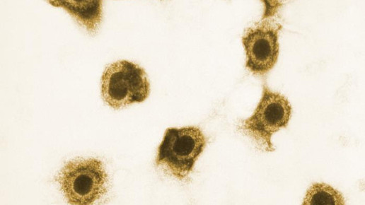 Prevymis: Prophylaxe für Organempfänger