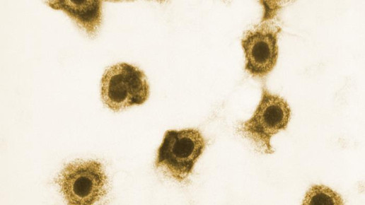 Cytomegalievirus CDC Sylvia Whitfield