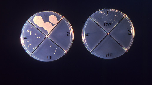 Tuberkuloseverdacht in Kita