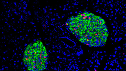 Betatrophin statt Insulinspritze