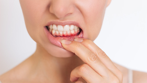 Sanomucin: Nährstoffkombi stärkt Schleimhaut