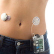 Medtronic ruft Insulin-Reservoire zurück