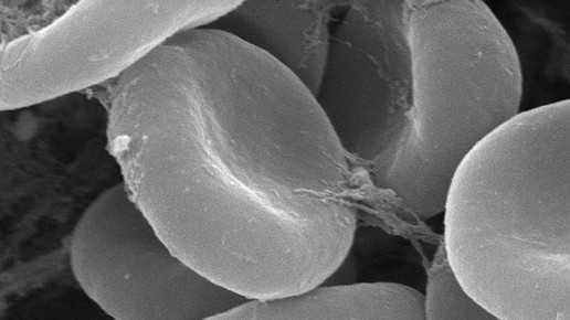 erythrozyt CDC Janice Carr