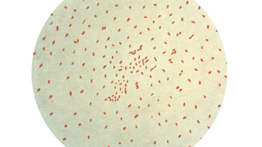 Bordetella pertussis CDC