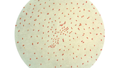 Bordetella pertussis CDC