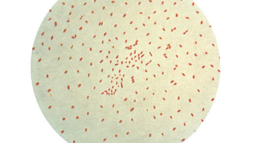Bordetella pertussis CDC