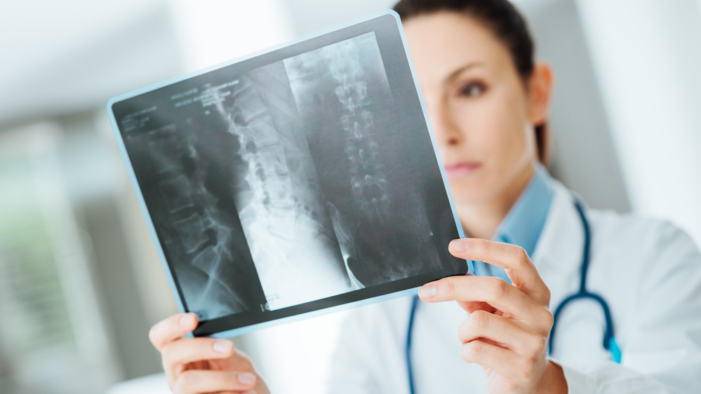 Osteoporose-Gl-tteunf-lle-und-viele-Knochenbr-che