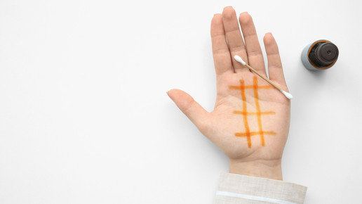 Eine Hand liegt auf dem Tisch, ein Gitter aus Jodlösung ist darafu gezeichnet.