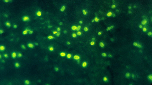 Haemophilus influenzae CDC