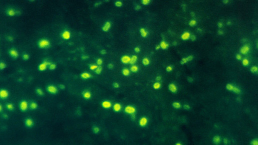 Haemophilus influenzae CDC