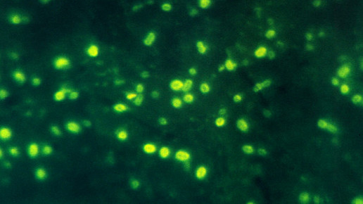Haemophilus influenzae CDC