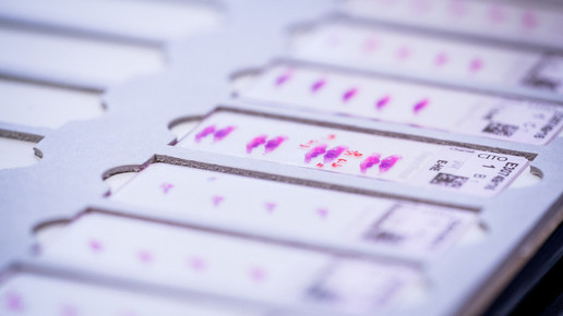 Immer mehr Menschen überleben Krebs