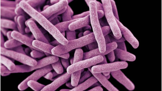 Mycobacterium tuberculosis 1 CDC