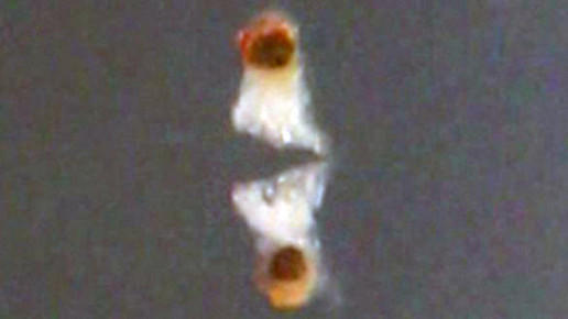 nanoroboter live tian qiu mpi