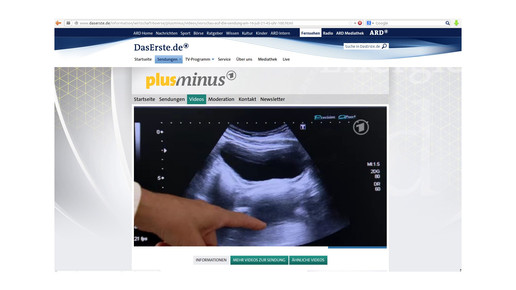 Plusminus: Krebs bei Ultraschall übersehen