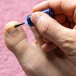 Foto: Eine Person mit mildem Nagelpilz am rechten Zeh trägt ein Präparat auf