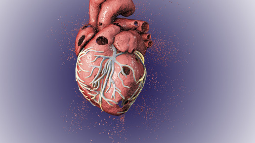 Amiodaron: Import wegen Engpass