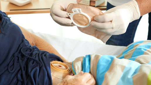 bvmed homecare4 stoma bvmed