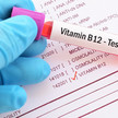 Vitamin B12 Test