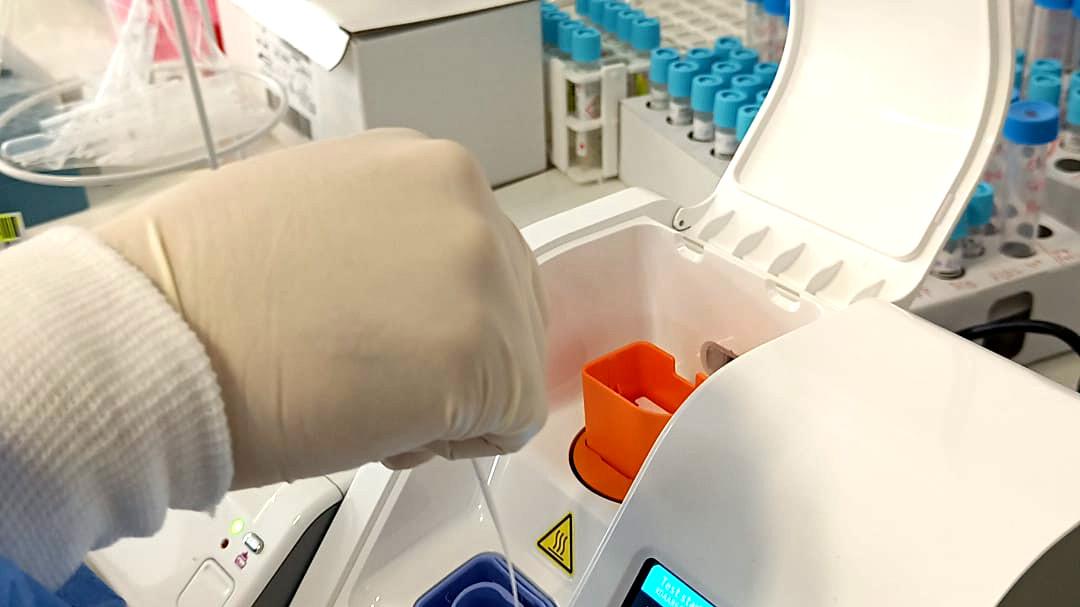 Abda: Mehr Geld für PCR- und Antigentests