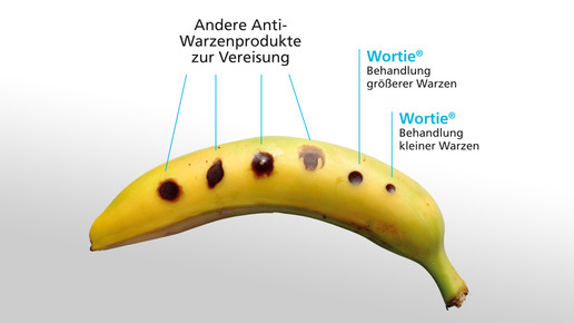 wortie banane wortie