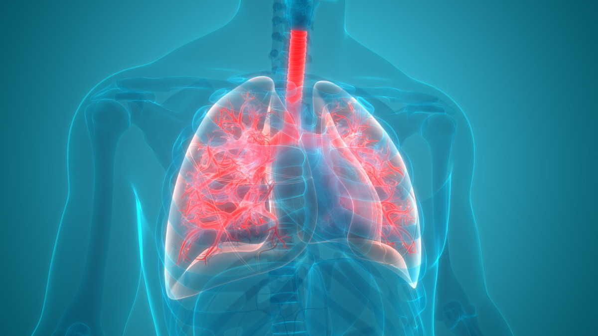 Pneumonie: Gefährliche Lungeninfektion