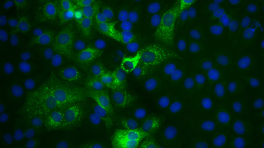 mers zellen Doreen Muth