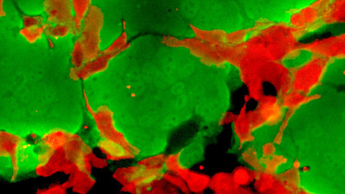 Photodynamische Therapie mit Tookad