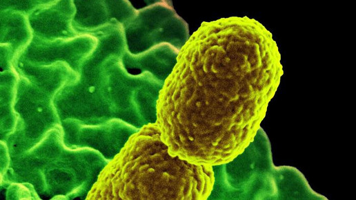 Klebsiella bakterium NIAID