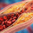 Neuer Wirkstoff gegen LDL-Cholesterin