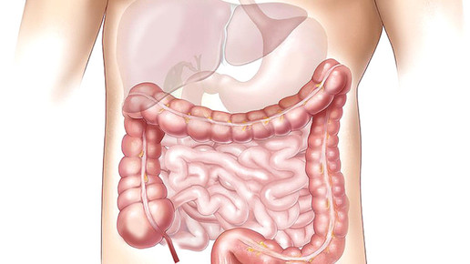 magen darm 01 pixabay