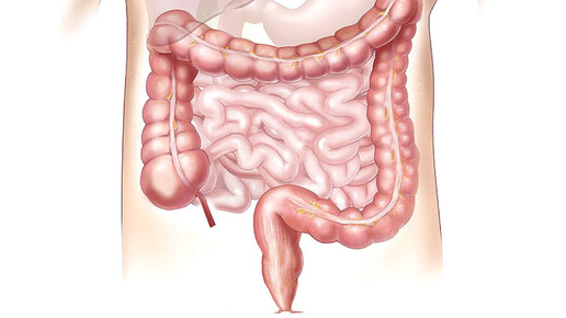 magen darm 01 pixabay