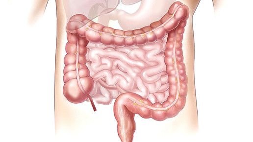 Biomarker für Reizdarm entdeckt