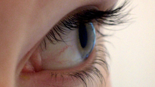 auge Mietze Mau pixelio