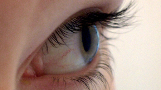 auge Mietze Mau pixelio